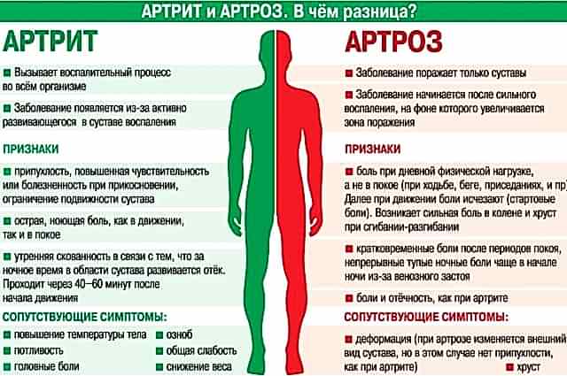 артрит и артроз отличия